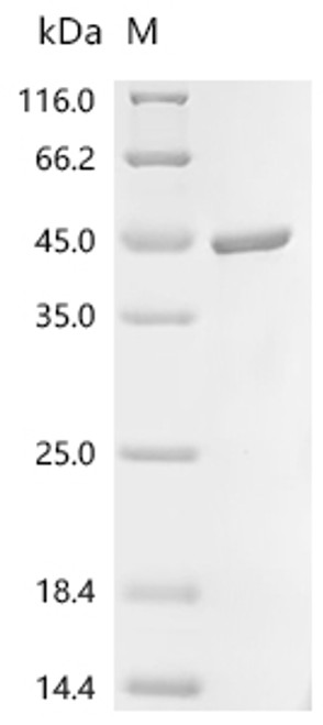 Recombinant Vaccinia virus Envelope protein H3 (OPG108), partial (CSB-EP324943VAA1d7)