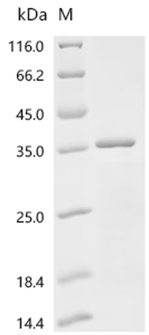 Recombinant Human Myelin transcription factor 1 (MYT1), partial (CSB-EP015387HUd7)