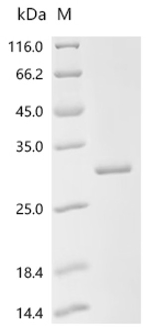 Recombinant Bovine Prolactin (PRL) (CSB-EP018724BOd7)