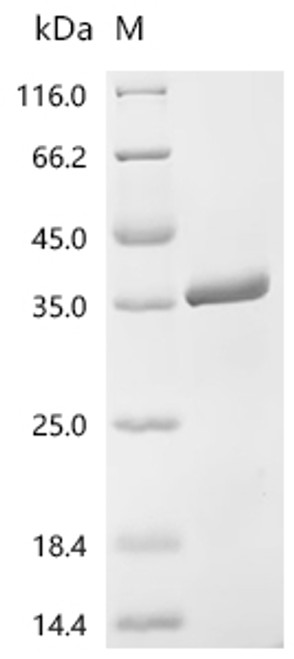 Recombinant Human Vesicle-associated membrane protein-associated protein A (VAPA), partial (CSB-EP878947HU)