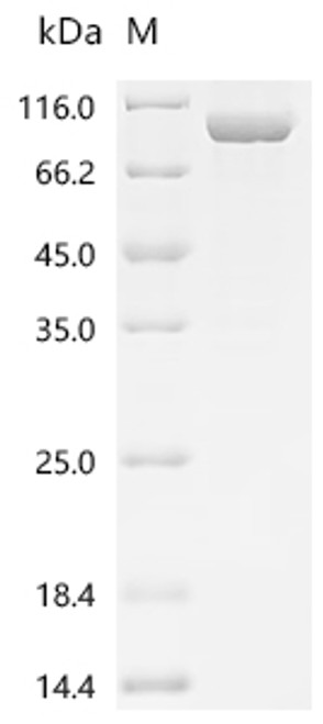 Recombinant Yellow fever virus Genome polyprotein, partial, Biotinylated (CSB-EP365905YAC1g10-B)