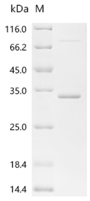 Recombinant Conus radiatus Iota-conotoxin-like r11c (CSB-EP770335CPD)