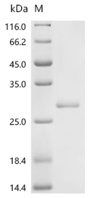 Recombinant Mouse Gamma-interferon-inducible lysosomal thiol reductase (Ifi30) (CSB-EP872152MO)