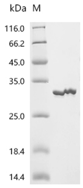 Recombinant Thermotoga neapolitana Endonuclease V (nfi) (CSB-EP495840TNL)