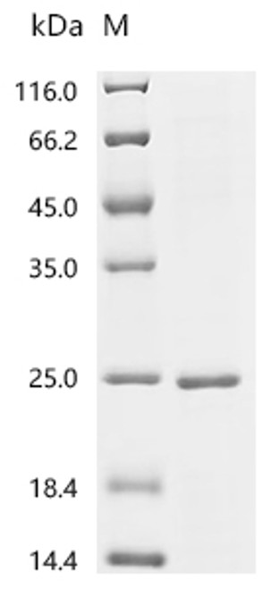 Recombinant Mouse Granulocyte-macrophage colony-stimulating factor (Csf2) (CSB-EP006045MOc7)