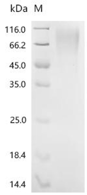 Recombinant Prunus persica Uncharacterized protein (CSB-YP6299EZK)