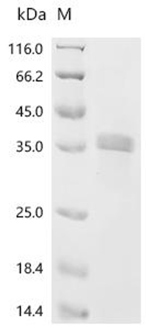 Recombinant Mouse Nephrin (Nphs1), partial (CSB-YP870792MO)