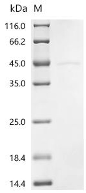 Recombinant Human Casein kinase I isoform delta (CSNK1D ) (CSB-BP006067HU)