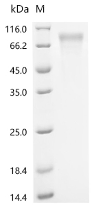 Recombinant Human ATP-dependent RNA helicase DDX3X (DDX3X ) (CSB-BP006621HUc7)
