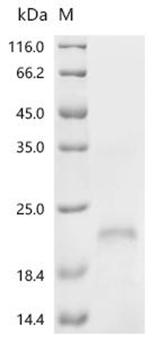 Recombinant Human Corticotropin-releasing factor receptor 1 (CRHR1 ), partial (CSB-BP005965HU)