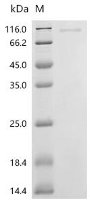 Recombinant Glycine max Protein kinase domain-containing protein, partial (CSB-BP6247GGV)