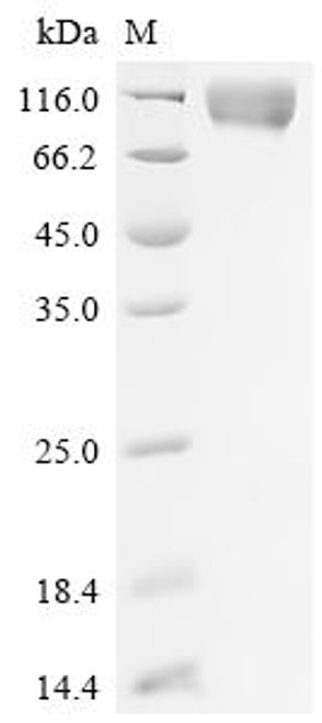 Recombinant Epstein-Barr virus envelope glycoprotein GP350 (BLLF1), partial (CSB-MP360986EFA)