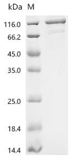 Recombinant Human Sodium/potassium-transporting ATPase subunit alpha-1 (ATP1A1), partial (CSB-MP002322HUp2)