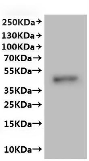 Recombinant Human Gap junction alpha-5 protein (GJA5)-VLPs (CSB-MP009448HU)