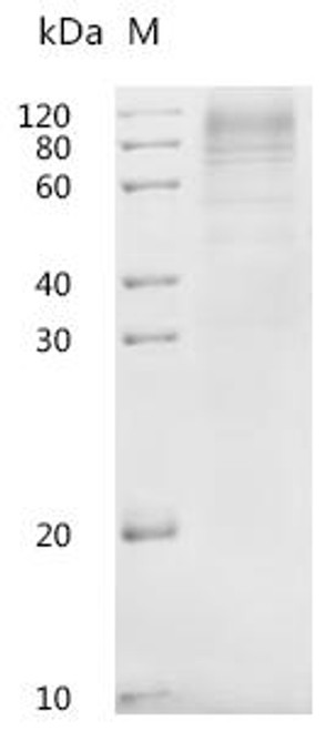 Recombinant Human Solute carrier family 23 member 2 (SLC23A2)-Detergent (CSB-MP866221HU(A4)-D)