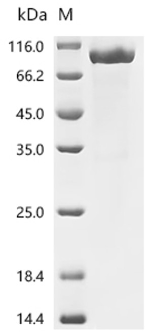 Recombinant Mouse Muscle, skeletal receptor tyrosine-protein kinase (Musk), partial (CSB-MP730715MO)