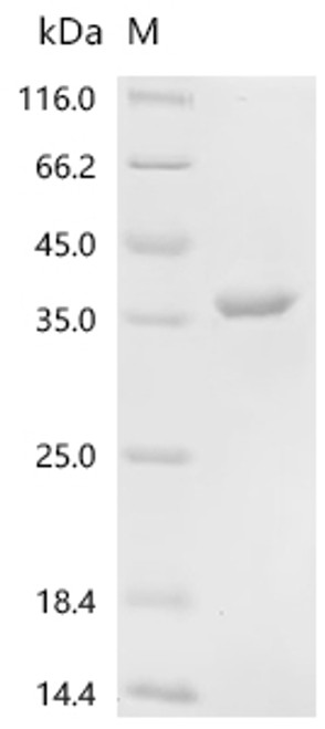 Recombinant Human Glyceraldehyde-3-phosphate dehydrogenase (GAPDH) (CSB-MP009232HU(A4))