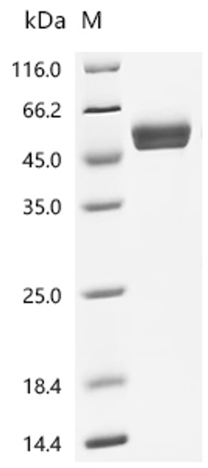 Recombinant Human Natural cytotoxicity triggering receptor 3 (NCR3), partial (Active) (CSB-MP015551HU1)