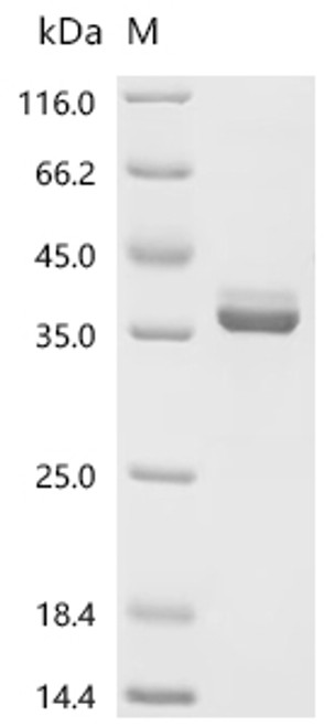 Recombinant Human Pro-epidermal growth factor (EGF), partial (CSB-MP007473HUd9)