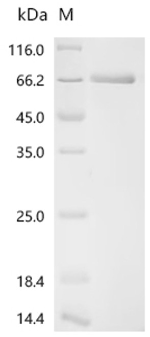 Recombinant Macaca fascicularis Growth arrest specific 6 (GAS6) (CSB-MP5039MOV)