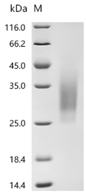 Recombinant Human Parathyroid hormone/parathyroid hormone-related peptide receptor (PTH1R), partial (Active) (CSB-MP018988HU)