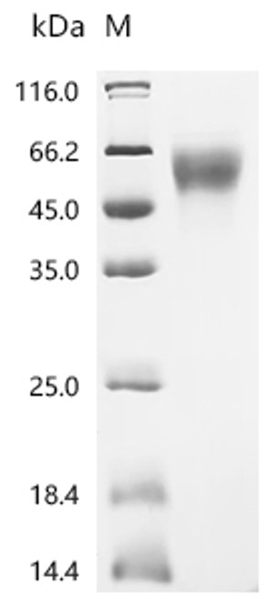 Recombinant Human V-set domain-containing T-cell activation inhibitor 1 (VTCN1) , partial (CSB-MP801822HU1)