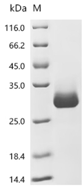 Recombinant Streptococcus sp. group G Immunoglobulin G-binding protein G (spg) , partial (CSB-MP322577SNDd7)