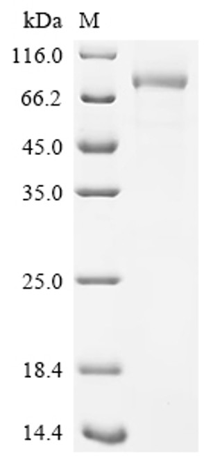 Recombinant Human Desmoglein-3 (DSG3), partial (CSB-MP007205HUj8-s)