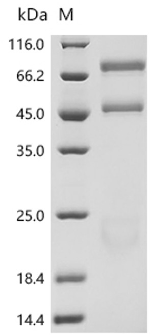 Recombinant Bovine Coagulation factor X (F10) (CSB-MP007915BO(A4))