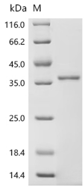 Recombinant Rat Insulin-1 (Ins1) (CSB-MP355622RA)
