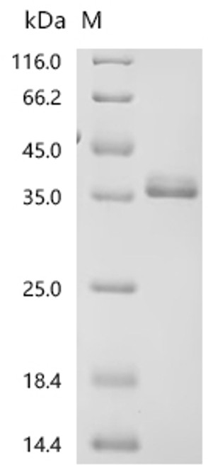 Recombinant Cavia porcellus Lipocalin Cav p 2.0101 (Lcncavp2) (CSB-YP306654GUa4)