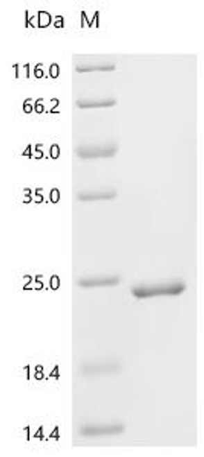 Recombinant Bacillus phage phi29 Histone-like protein p6 (6) (CSB-EP356118BBC)