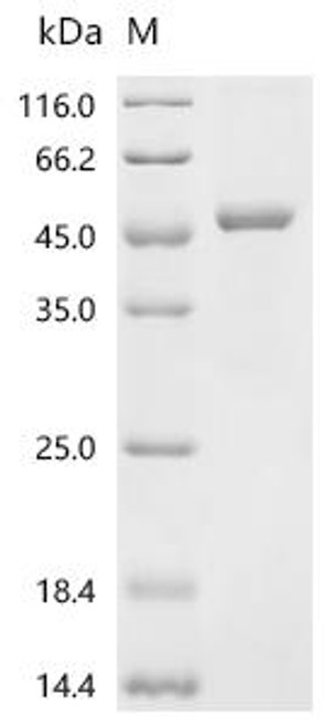 Recombinant Human Alcohol dehydrogenase 1A (ADH1A) (CSB-EP001353HU)