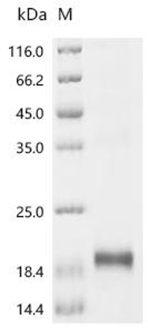 Recombinant Bovine Muellerian-inhibiting factor (AMH), partial (CSB-EP001666BO1b1)