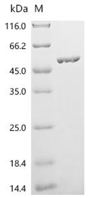 Recombinant Streptococcus agalactiae C protein beta antigen (bac), partial (CSB-EP028048SMF)
