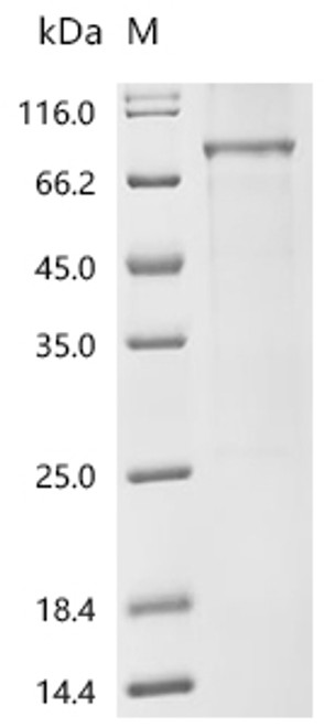 Recombinant Mouse Basic helix-loop-helix ARNT-like protein 1 (Bmal1) (CSB-EP895734MO)