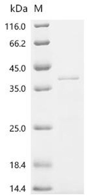Recombinant Bordetella pertussis BrkA autotransporter (brkA), partial (CSB-EP673803BUA2c7)