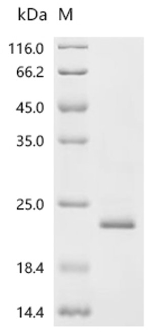Recombinant Human Calcium homeostasis modulator protein 2 (CALHM2), partial (CSB-EP888009HU1)