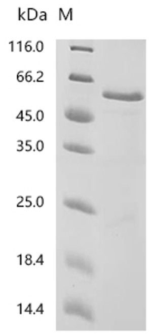 Recombinant Human Cholesteryl ester transfer protein (CETP) (CSB-EP005267HUb1) Recombinant Human Cholesteryl ester transfer protein (CETP) (CSB-EP005267HUb1)