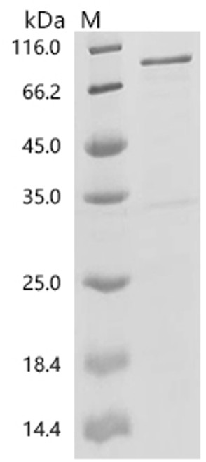 Recombinant Human Acetylcholine receptor subunit alpha (CHRNA1), partial (CSB-EP005386HUe9) Recombinant Human Acetylcholine receptor subunit alpha (CHRNA1), partial (CSB-EP005386HUe9)
