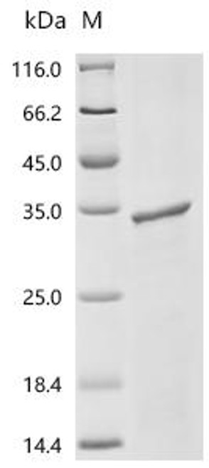 Recombinant Human Acetylcholine receptor subunit epsilon (CHRNE), partial (CSB-EP005400HU1a0) Recombinant Human Acetylcholine receptor subunit epsilon (CHRNE), partial (CSB-EP005400HU1a0)