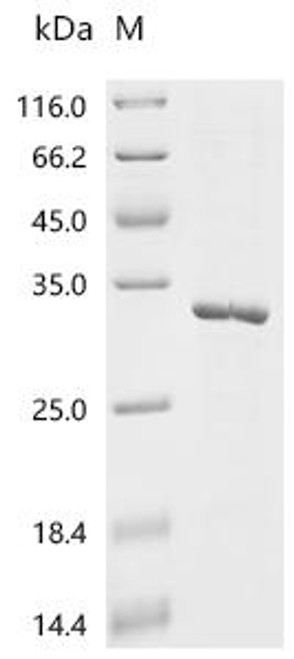 Recombinant Human C-reactive protein (CRP) (CSB-EP005991HU) Recombinant Human C-reactive protein (CRP) (CSB-EP005991HU)