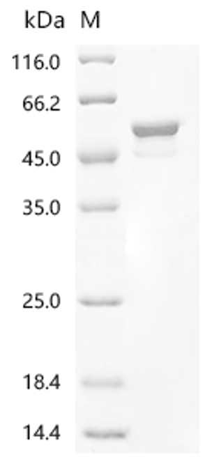 Recombinant Coccidioides immitis Endochitinase 1 (CTS1) (CSB-EP627763DUV) Recombinant Coccidioides immitis Endochitinase 1 (CTS1) (CSB-EP627763DUV)