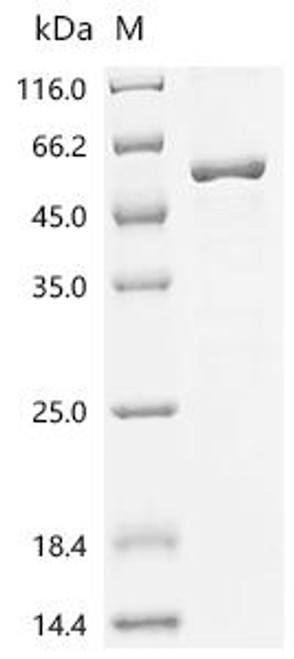Recombinant Mouse 1,25-dihydroxyvitamin D(3) 24-hydroxylase, mitochondrial(Cyp24a1) (CSB-EP714493MOe1)