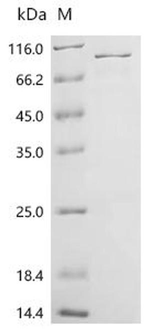 Recombinant Human Disabled homolog 1 (DAB1) (CSB-EP006479HU) Recombinant Human Disabled homolog 1 (DAB1) (CSB-EP006479HU)