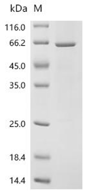 Recombinant Human ATP-dependent RNA helicase DDX39A (DDX39A) (CSB-EP006620HU) Recombinant Human ATP-dependent RNA helicase DDX39A (DDX39A) (CSB-EP006620HU)