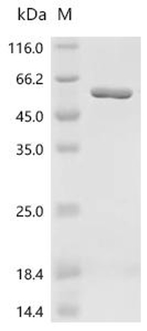 Recombinant Staphylococcus aureus Enolase (eno) (CSB-EP647472SKU) Recombinant Staphylococcus aureus Enolase (eno) (CSB-EP647472SKU)