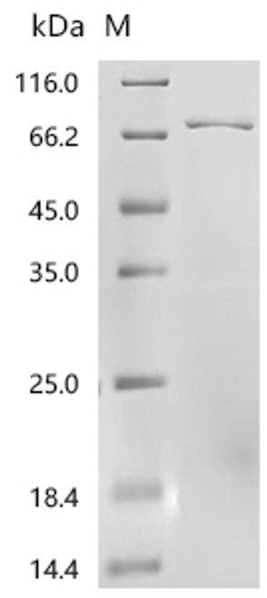 Recombinant Human Flavin-containing monooxygenase 5 (FMO5) (CSB-EP008751HU(A4)) Recombinant Human Flavin-containing monooxygenase 5 (FMO5) (CSB-EP008751HU(A4))