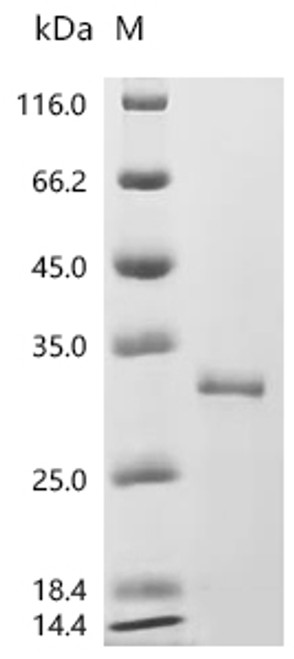 Recombinant Human Ferritin heavy chain (FTH1) (CSB-EP009030HU) Recombinant Human Ferritin heavy chain (FTH1) (CSB-EP009030HU)