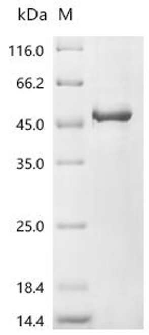 Recombinant Human Glycogen synthase kinase-3 beta (GSK3B) (CSB-EP009963HUe2) Recombinant Human Glycogen synthase kinase-3 beta (GSK3B) (CSB-EP009963HUe2)